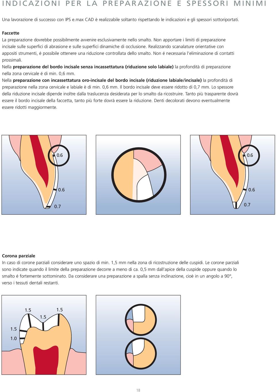 Non apportare i limiti di preparazione incisale sulle superfici di abrasione e sulle superfici dinamiche di occlusione.