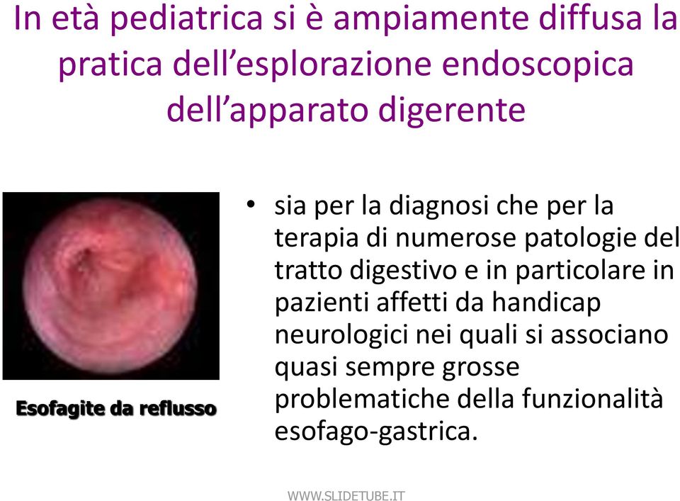 patologie del tratto digestivo e in particolare in pazienti affetti da handicap neurologici