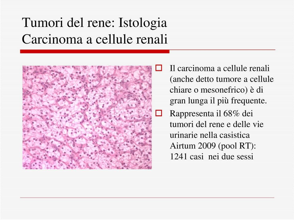 più frequente.