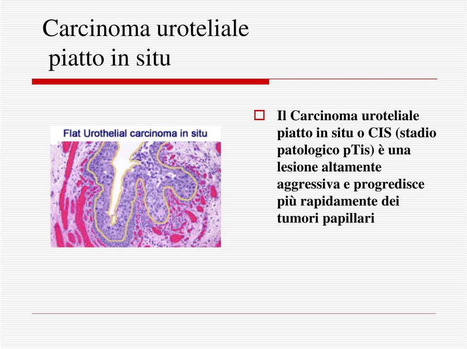 (stadio patologico ptis) è una lesione