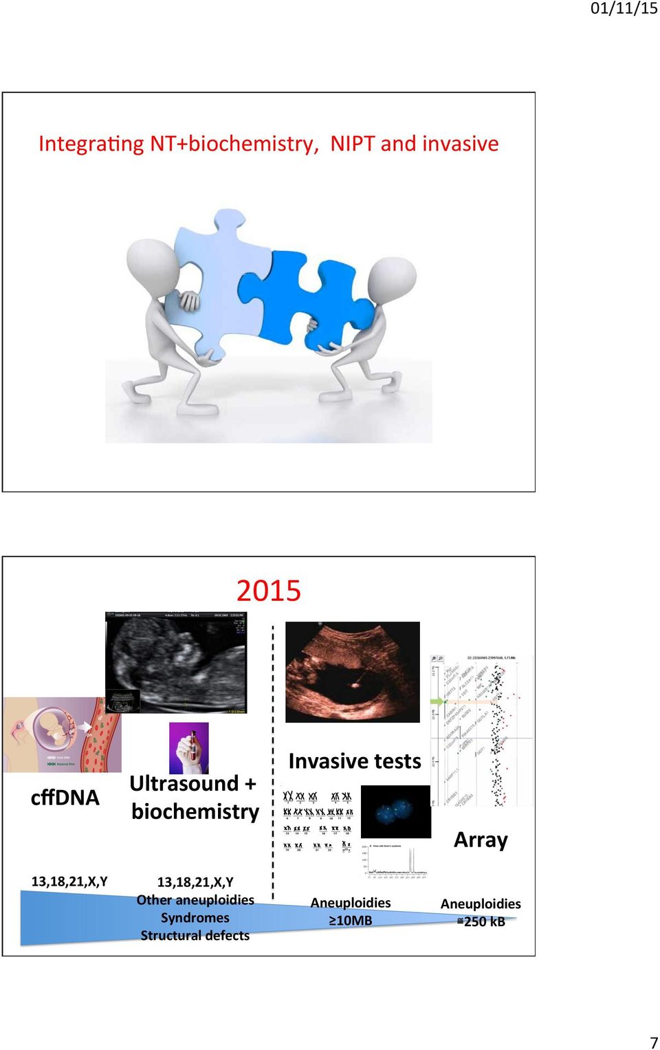 13,18,21,X,Y 13,18,21,X,Y Other aneuploidies Syndromes