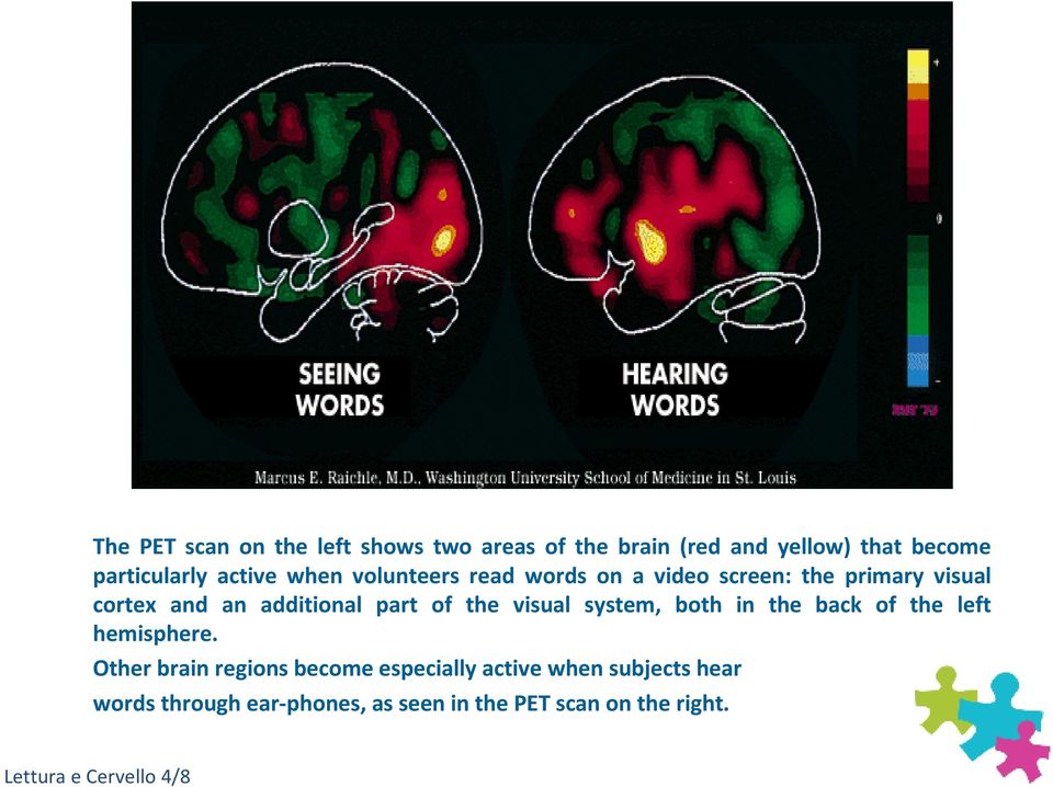 visual system, both in the back of the left hemisphere.