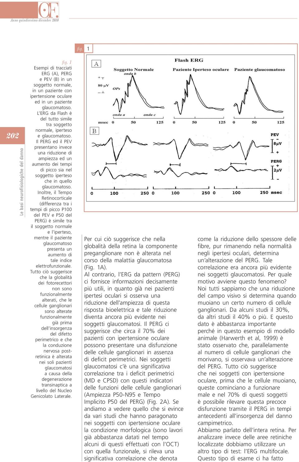 PERG ed il PEV presentano invece una riduzione di ampiezza ed un aumento dei tempi di picco sia nel soggetto iperteso che in quello Inoltre, il Tempo Retinocorticale (differenza tra i tempi di picco