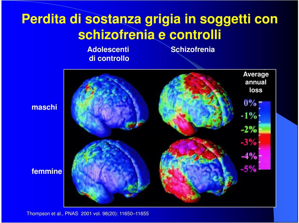 Schizofrenia di controllo Average annual loss