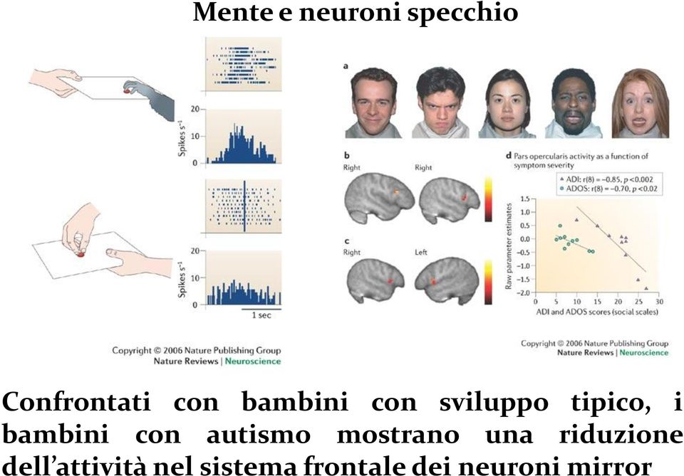 con autismo mostrano una riduzione dell