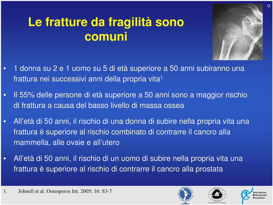 subire nella propria vita una frattura è superiore al rischio combinato di contrarre il cancro alla mammella, alle ovaie e all utero All età di 50 anni, il rischio