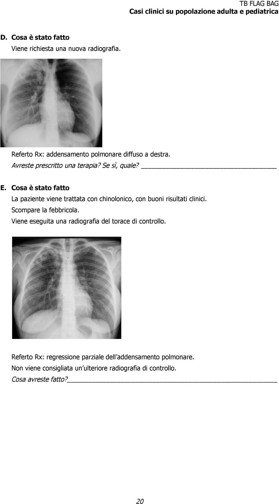 Cosa è stato fatto La paziente viene trattata con chinolonico, con buoni risultati clinici. Scompare la febbricola.