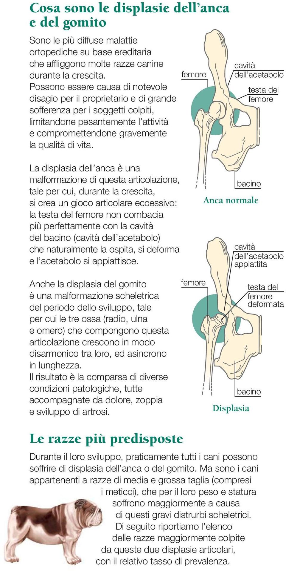 femore cavità dell acetabolo testa del femore La displasia dell anca è una malformazione di questa articolazione, tale per cui, durante la crescita, si crea un gioco articolare eccessivo: la testa