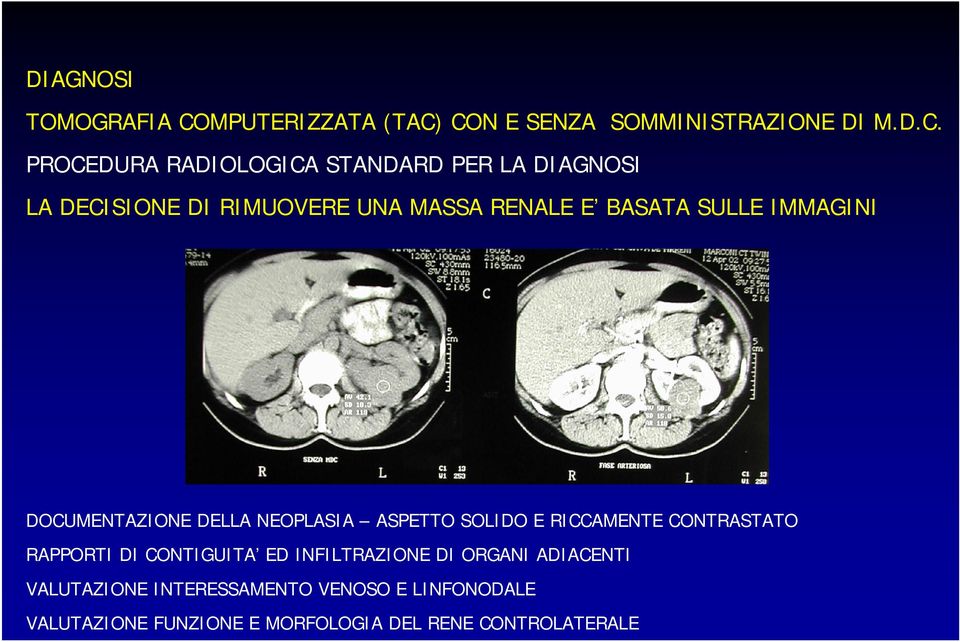 CON E SENZA SOMMINISTRAZIONE DI M.D.C. PROCEDURA RADIOLOGICA STANDARD PER LA DIAGNOSI LA DECISIONE DI