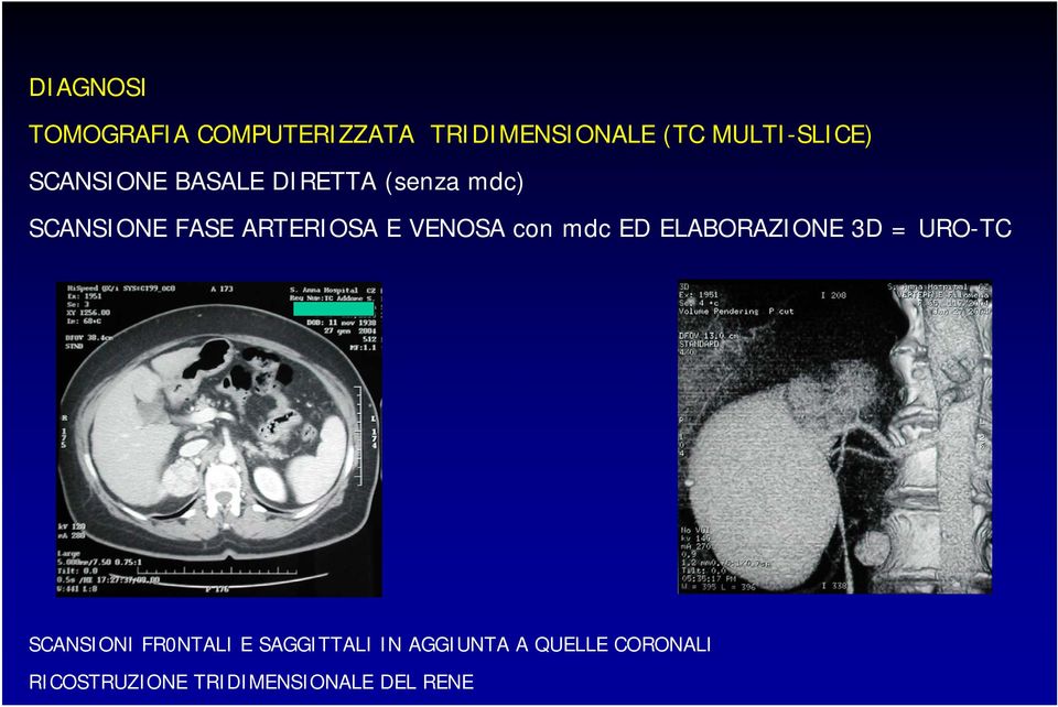 VENOSA con mdc ED ELABORAZIONE 3D = URO-TC SCANSIONI FR0NTALI E