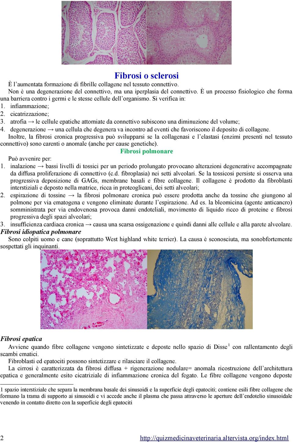 atrofia le cellule epatiche attorniate da connettivo subiscono una diminuzione del volume; 4. degenerazione una cellula che degenera va incontro ad eventi che favoriscono il deposito di collagene.