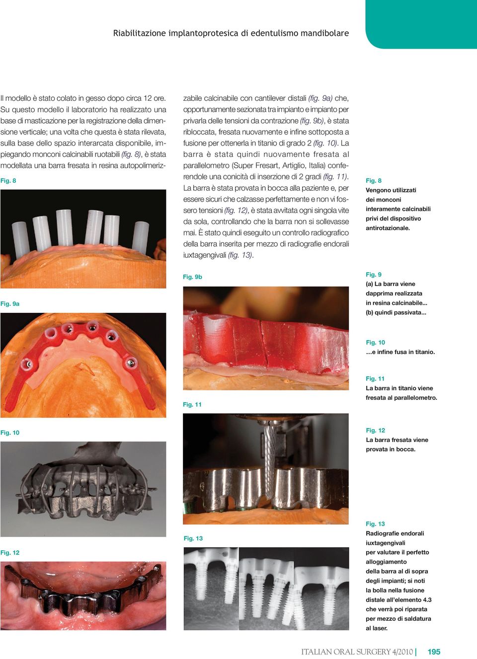 disponibile, impiegando monconi calcinabili ruotabili (fig. 8), è stata modellata una barra fresata in resina autopolimerizzabile calcinabile con cantilever distali (fig.