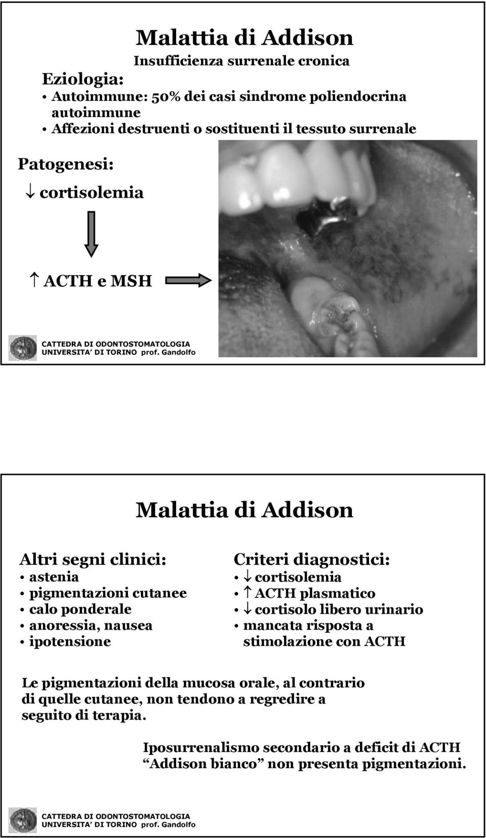 ipotensione Criteri diagnostici: cortisolemia ACTH plasmatico cortisolo libero urinario mancata risposta a stimolazione con ACTH Le pigmentazioni della mucosa