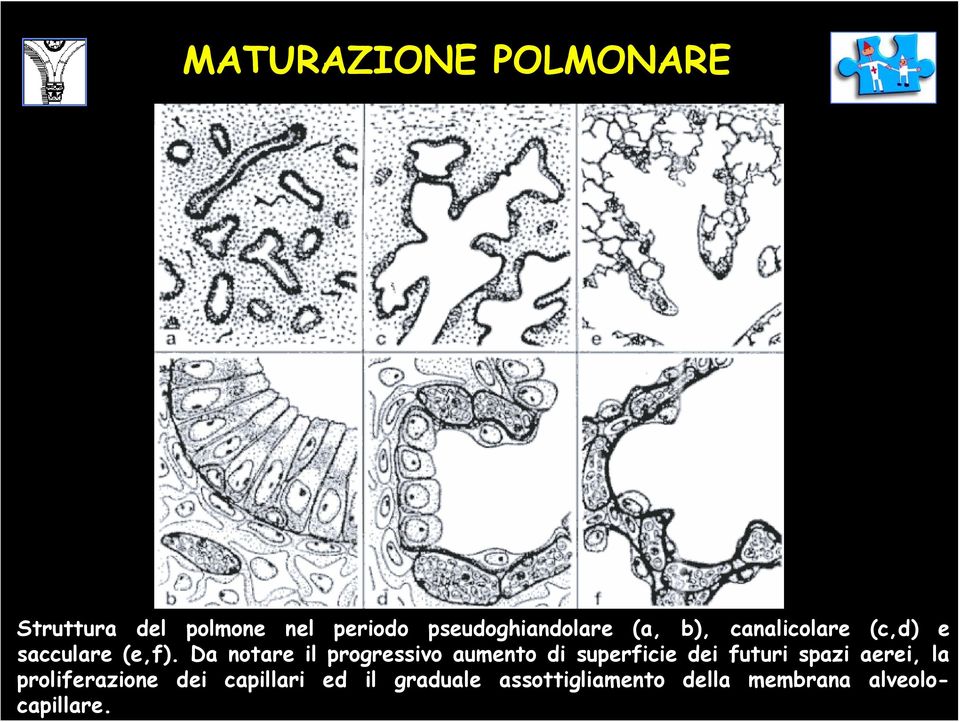 Da notare il progressivo aumento di superficie dei futuri spazi aerei,