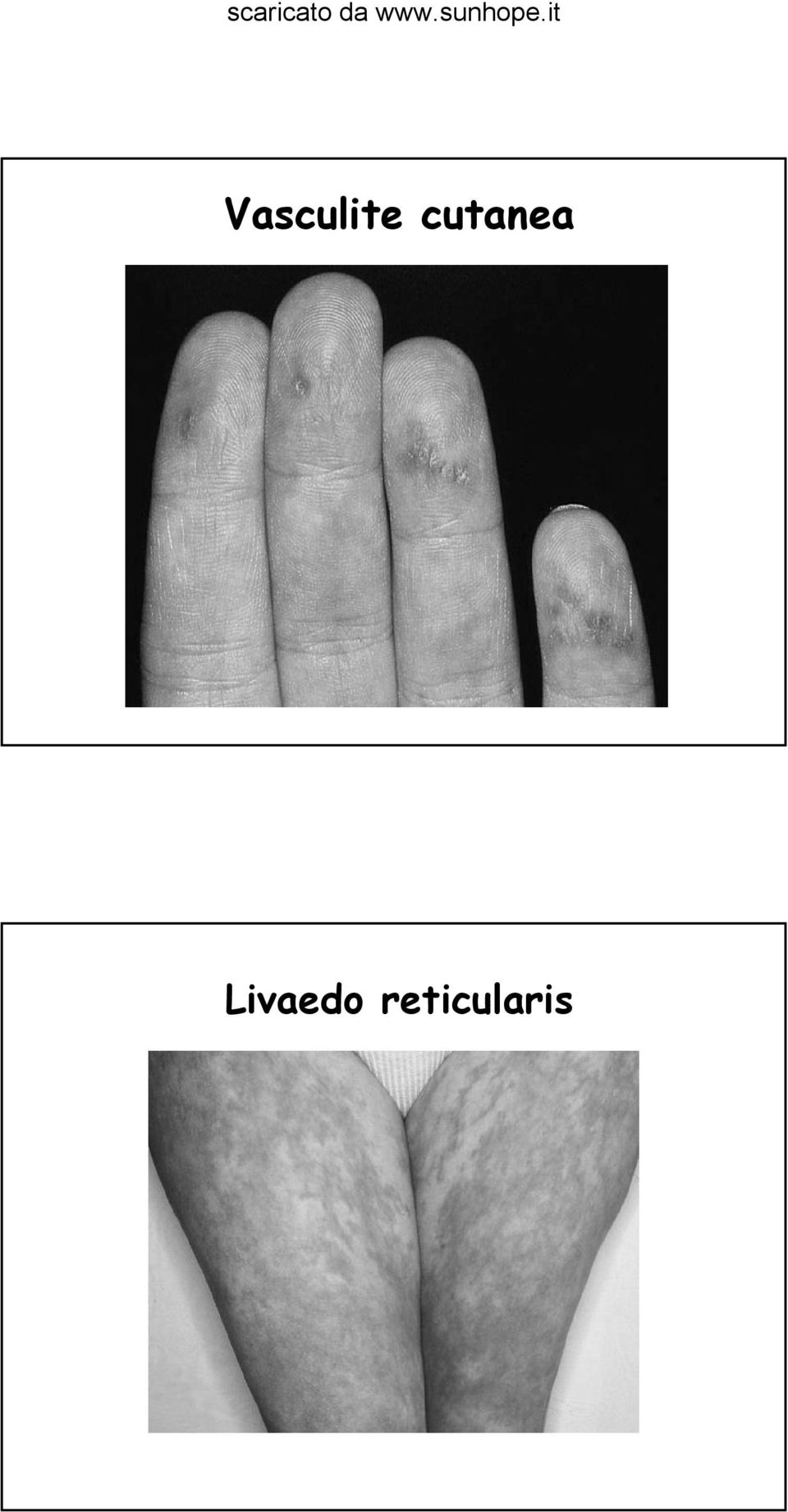 Livaedo