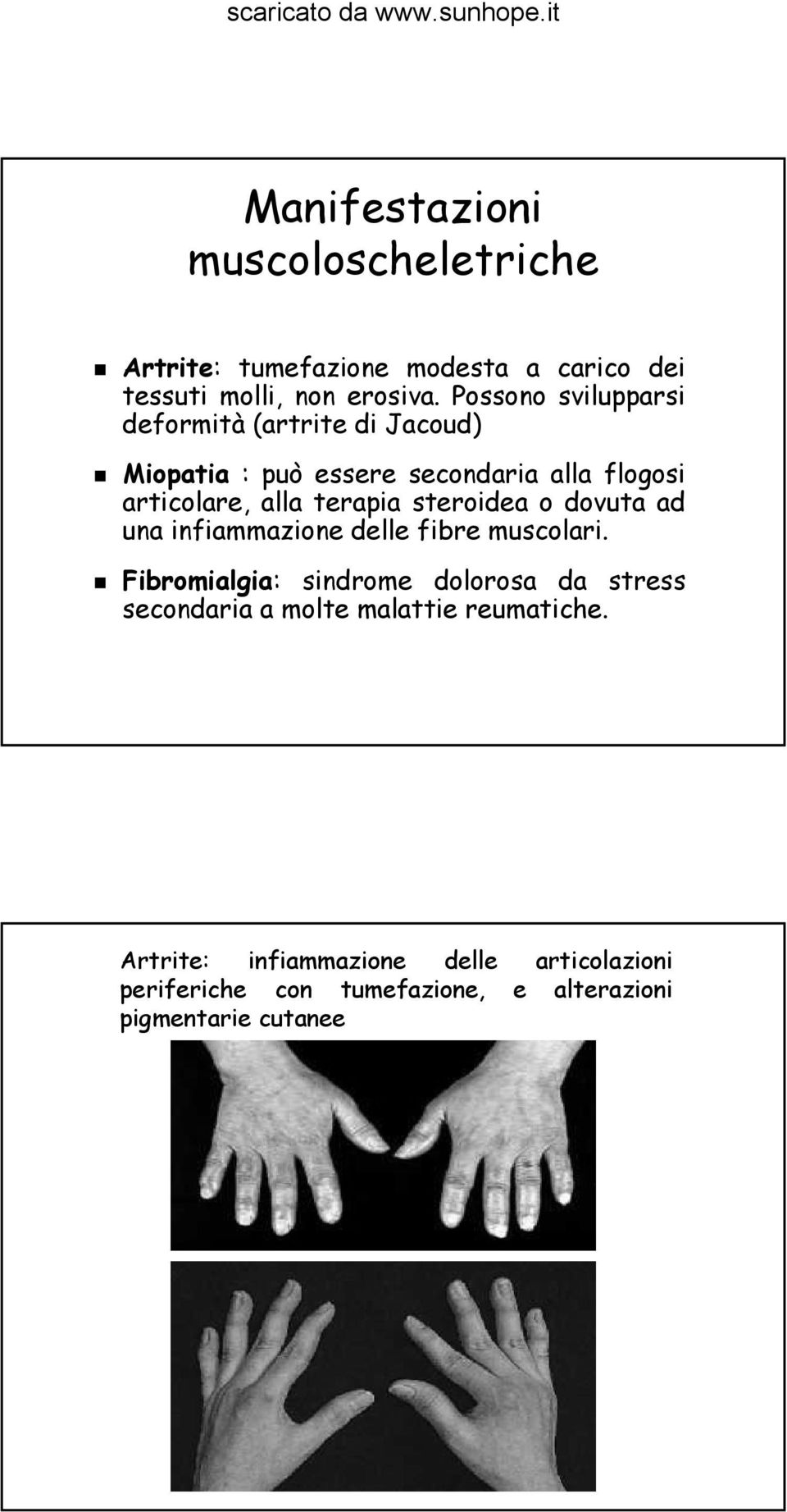 terapia steroidea o dovuta ad una infiammazione delle fibre muscolari.