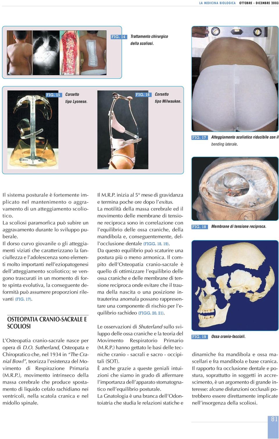 Il dorso curvo giovanile o gli atteggiamenti viziati che caratterizzano la fanciullezza e l adolescenza sono elementi molto importanti nell eziopatogenesi dell atteggiamento scoliotico; se vengono