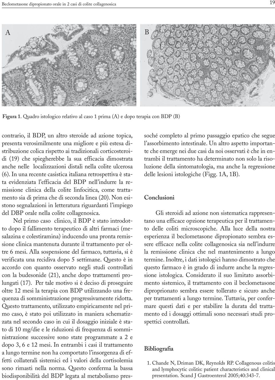 rispetto ai tradizionali corticosteroidi (19) che spiegherebbe la sua efficacia dimostrata anche nelle localizzazioni distali nella colite ulcerosa (6).