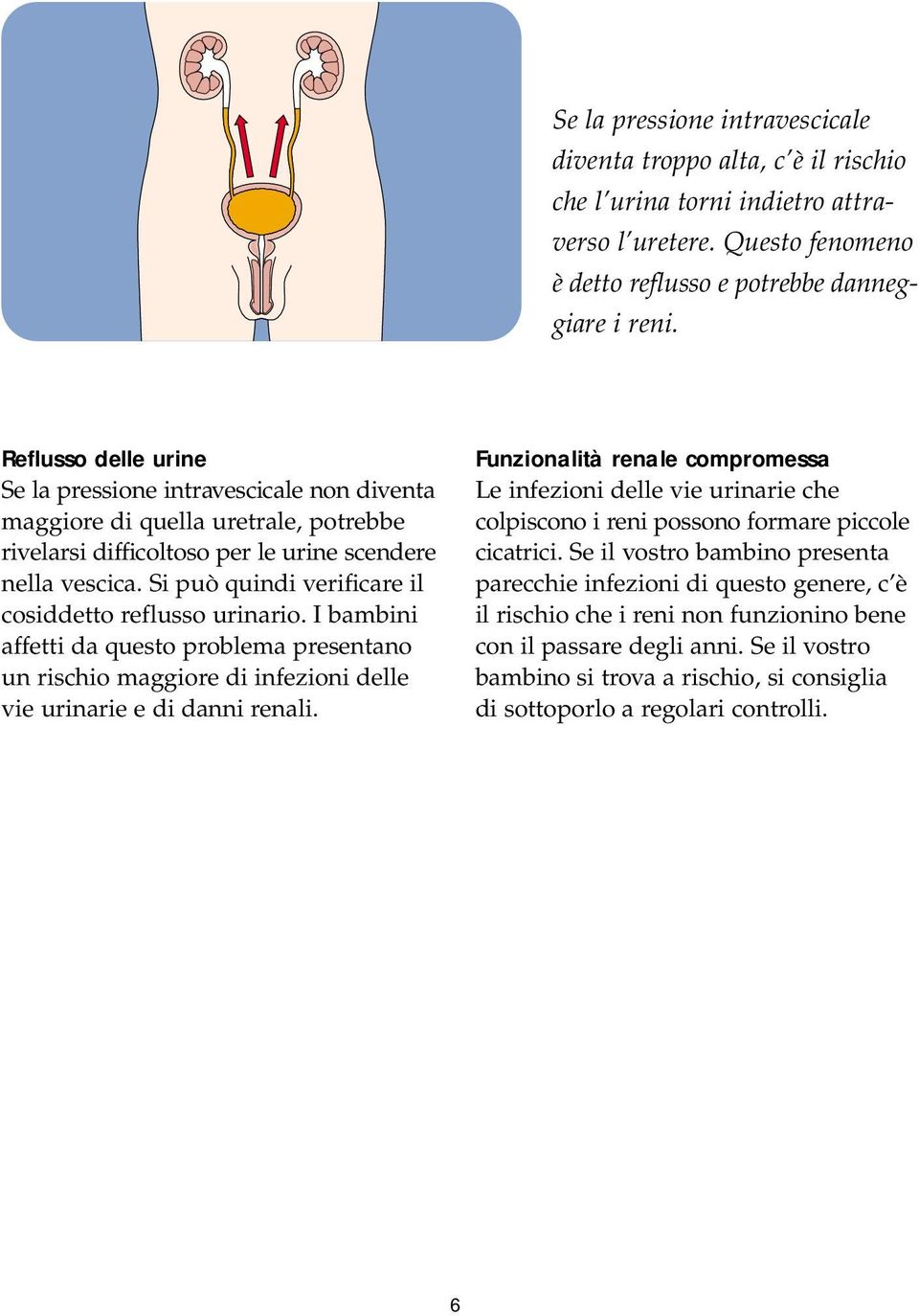 Si può quindi verificare il cosiddetto reflusso urinario. I bambini affetti da questo problema presentano un rischio maggiore di infezioni delle vie urinarie e di danni renali.