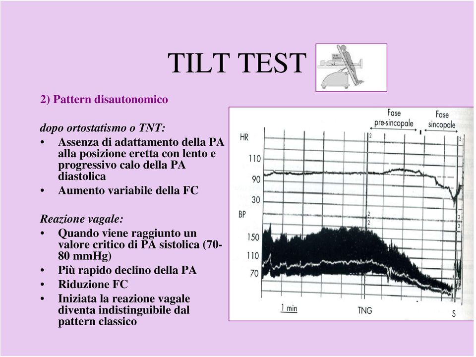 Reazione vagale: Quando viene raggiunto un valore critico di PA sistolica (70-80 mmhg) Più rapido