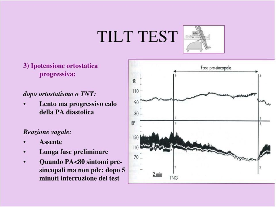 diastolica Reazione vagale: Assente Lunga fase preliminare