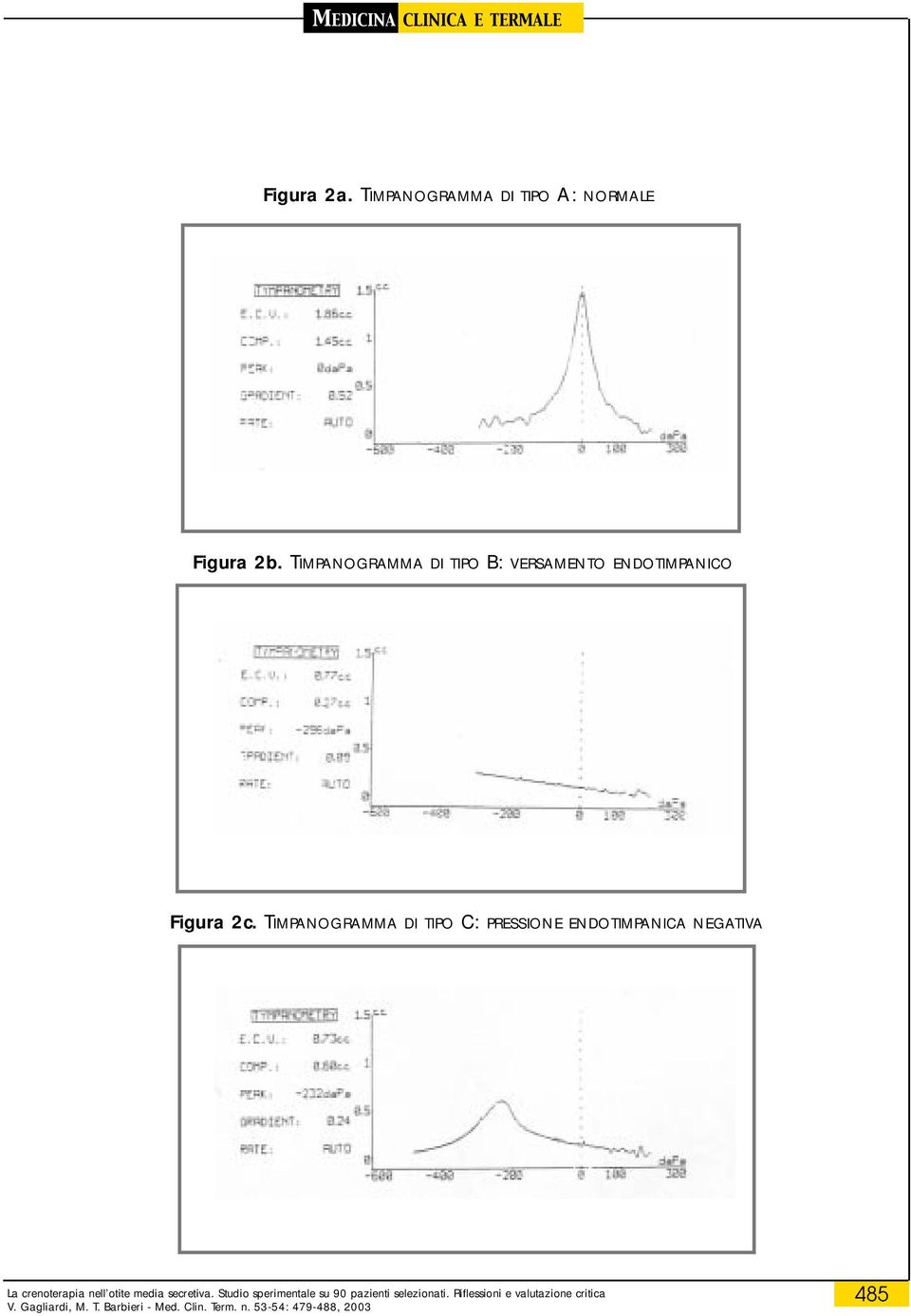 TIMPANOGRAMMA DI TIPO C: PRESSIONE ENDOTIMPANICA NEGATIVA La crenoterapia