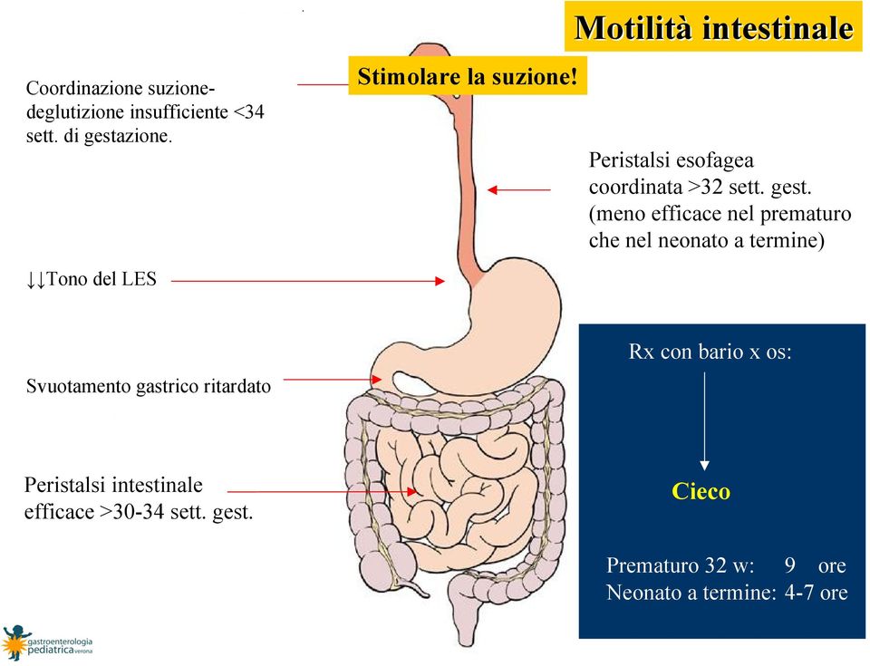 (meno efficace nel prematuro che nel neonato a termine) Tono del LES Svuotamento gastrico