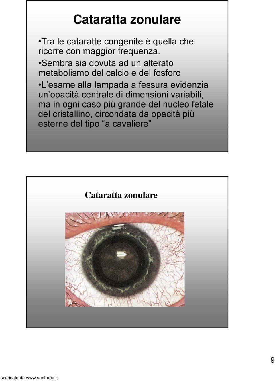 fessura evidenzia un opacità centrale di dimensioni variabili, ma in ogni caso più grande del