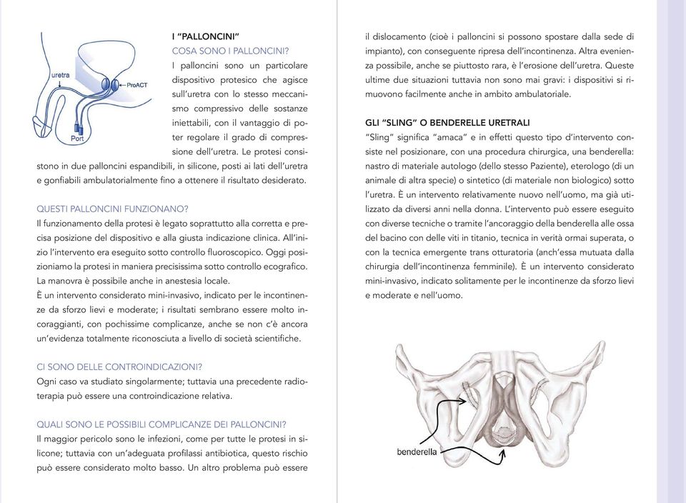 compressione dell uretra. Le protesi consistono in due palloncini espandibili, in silicone, posti ai lati dell uretra e gonfiabili ambulatorialmente fino a ottenere il risultato desiderato.