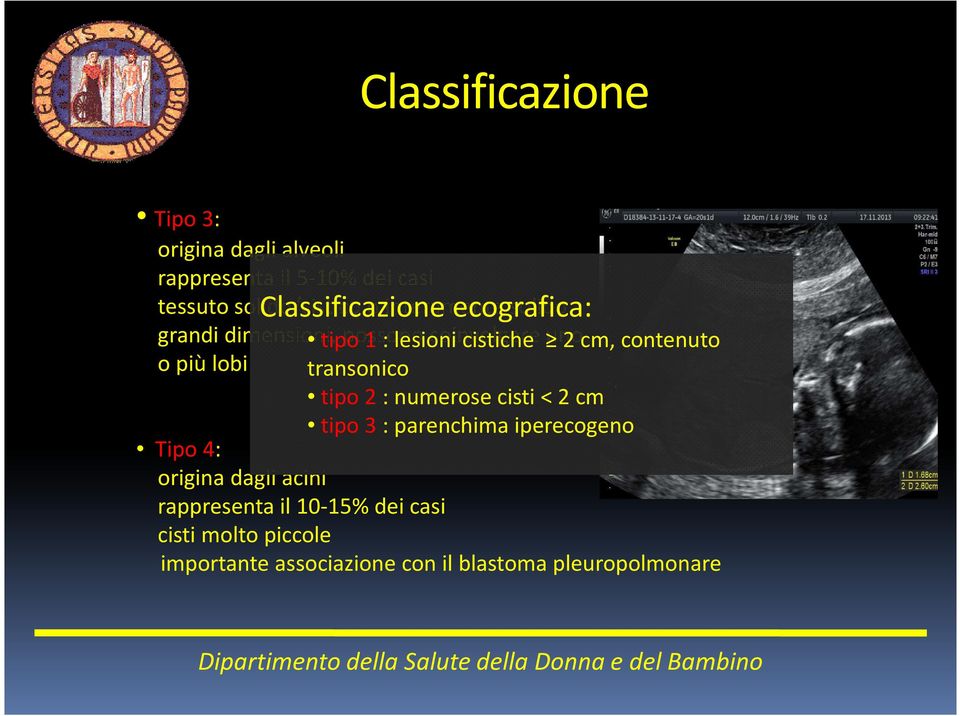 cistiche uno 2 cm, contenuto o più lobi transonico tipo 2 : numerose cisti < 2 cm tipo 3 : parenchima