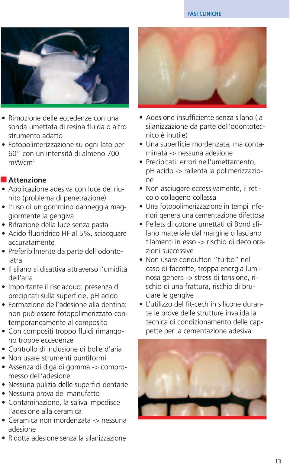 Preferibilmente da parte dell odontoiatra Il silano si disattiva attraverso l umidità dell aria Importante il risciacquo: presenza di precipitati sulla superficie, ph acido Formazione dell adesione