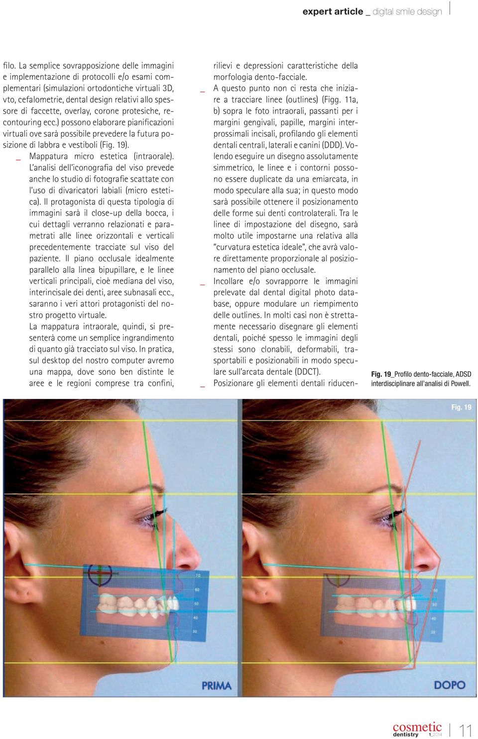 _ Mappatura micro estetica (intraorale). L analisi dell iconograia del viso prevede anche lo studio di fotograie scattate con l uso di divaricatori labiali (micro estetica).