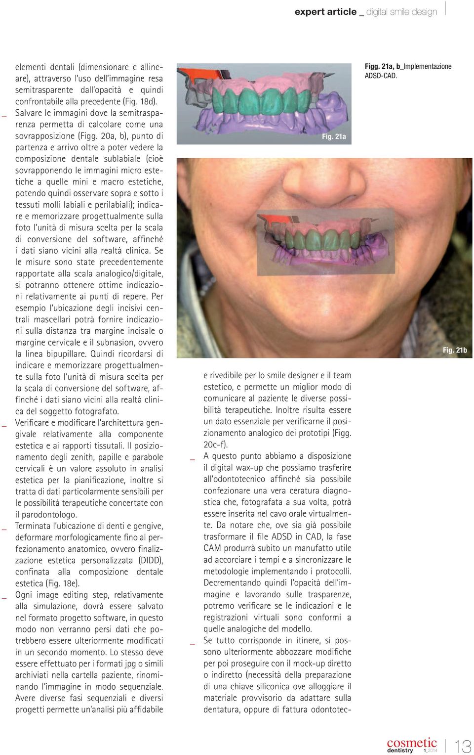 20a, b), punto di partenza e arrivo oltre a poter vedere la composizione dentale sublabiale (cioè sovrapponendo le immagini micro estetiche a quelle mini e macro estetiche, potendo quindi osservare