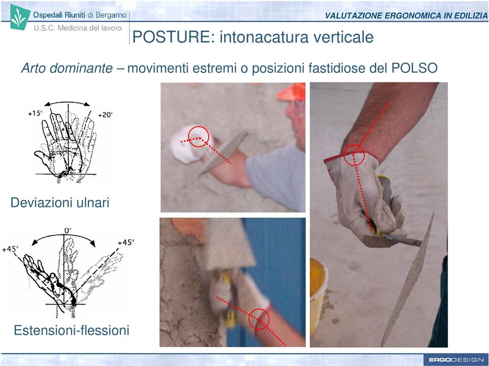 intonacatura verticale Arto dominante