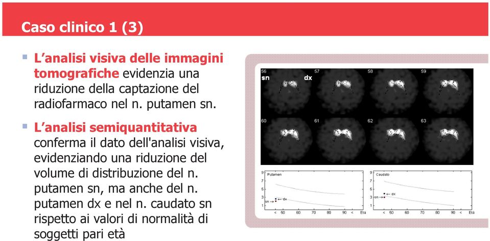 L analisi semiquantitativa conferma il dato dell'analisi visiva, evidenziando una riduzione