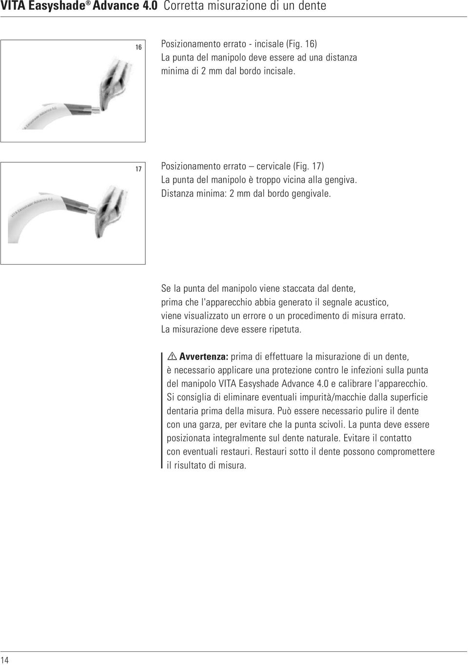 Se la punta del manipolo viene staccata dal dente, prima che l'apparecchio abbia generato il segnale acustico, viene visualizzato un errore o un procedimento di misura errato.