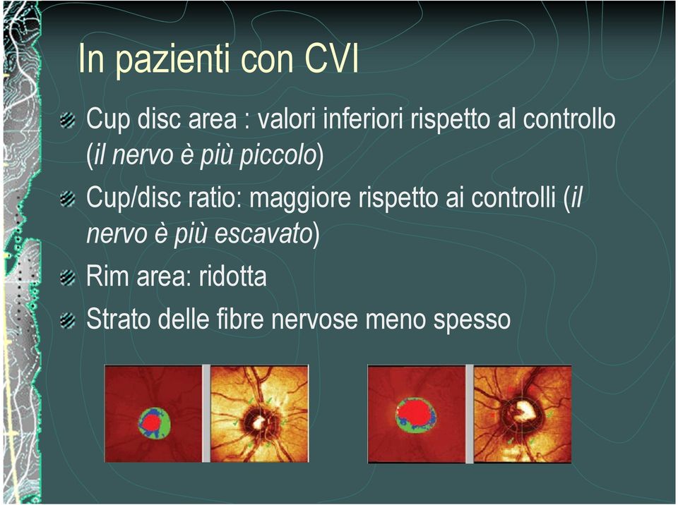 ratio: maggiore rispetto ai controlli (il nervo è più