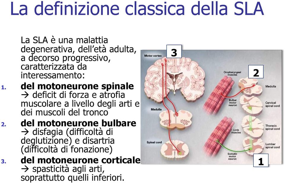 del motoneurone spinale deficit di forza e atrofia muscolare a livello degli arti e dei muscoli del tronco 2.