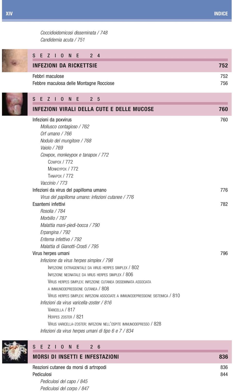 772 MONKEYPOX / 772 TANAPOX / 772 Vaccinio / 773 Infezioni da virus del papilloma umano 776 Virus del papilloma umano: infezioni cutanee / 776 Esantemi infettivi 782 Rosolia / 784 Morbillo / 787