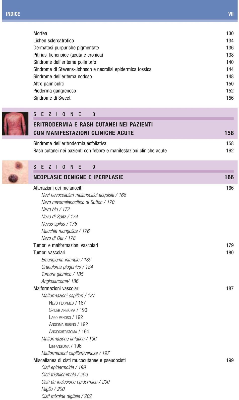 MANIFESTAZIONI CLINICHE ACUTE 158 Sindrome dell eritrodermia esfoliativa 158 Rash cutanei nei pazienti con febbre e manifestazioni cliniche acute 162 S E Z I O N E 9 NEOPLASIE BENIGNE E IPERPLASIE