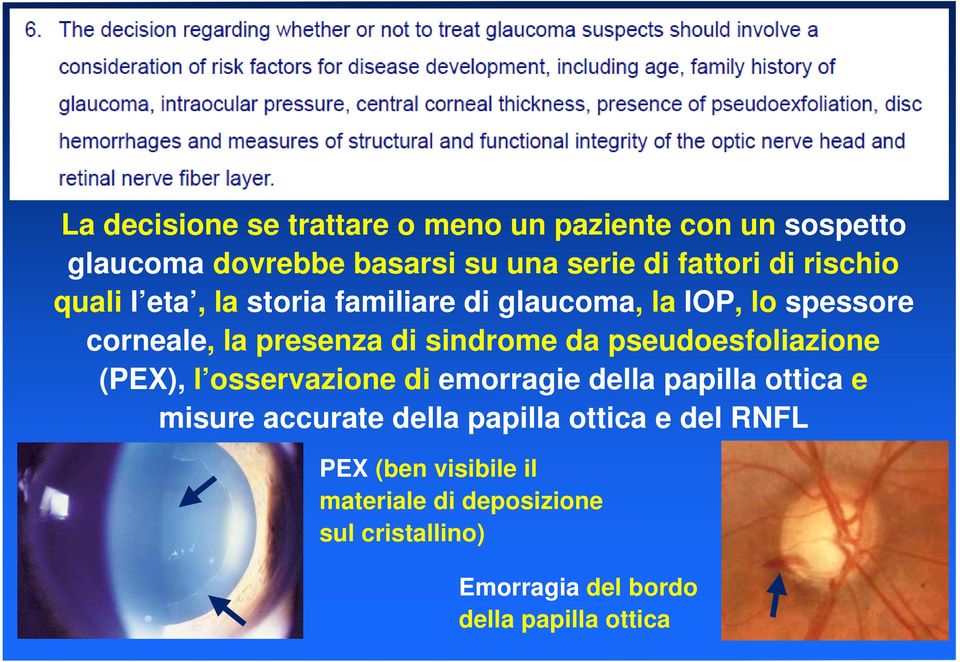 pseudoesfoliazione (PEX), l osservazione di emorragie della papilla ottica e misure accurate della papilla