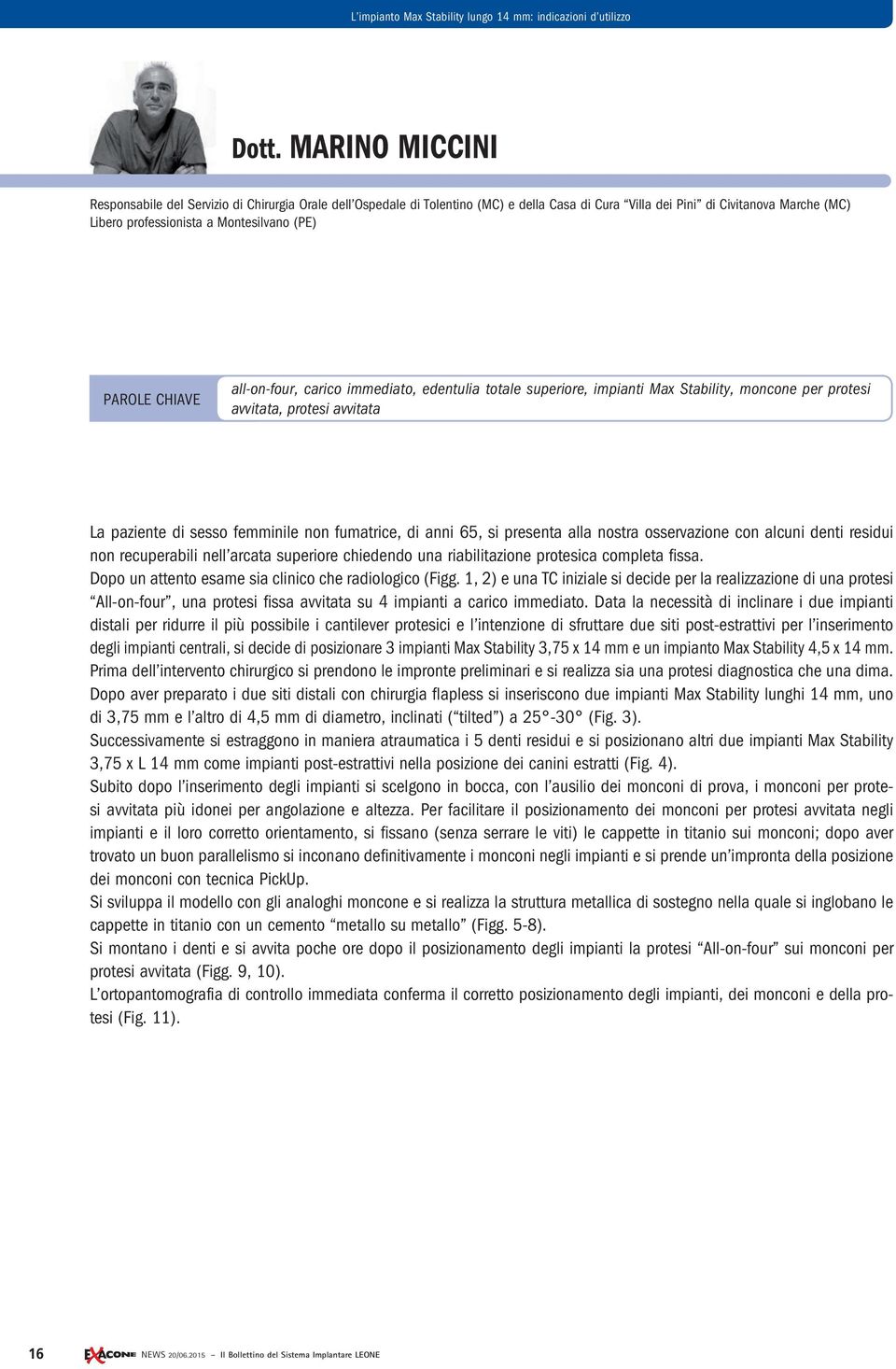 PAROLE CHIAVE all-on-four, carico immediato, edentulia totale superiore, impianti Max Stability, moncone per protesi avvitata, protesi avvitata La paziente di sesso femminile non fumatrice, di anni