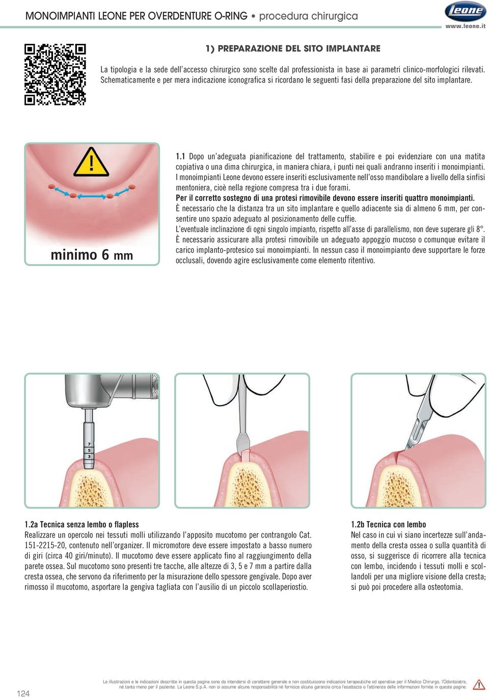 Schematicamente e per mera indicazione iconografica si ricordano le seguenti fasi della preparazione del sito implantare. minimo 6 mm 1.