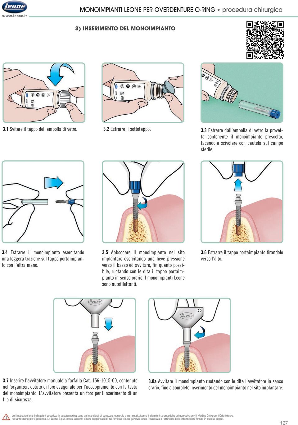 3.4 Estrarre il monoimpianto esercitando una leggera trazione sul tappo portaimpianto con l altra mano. 3.