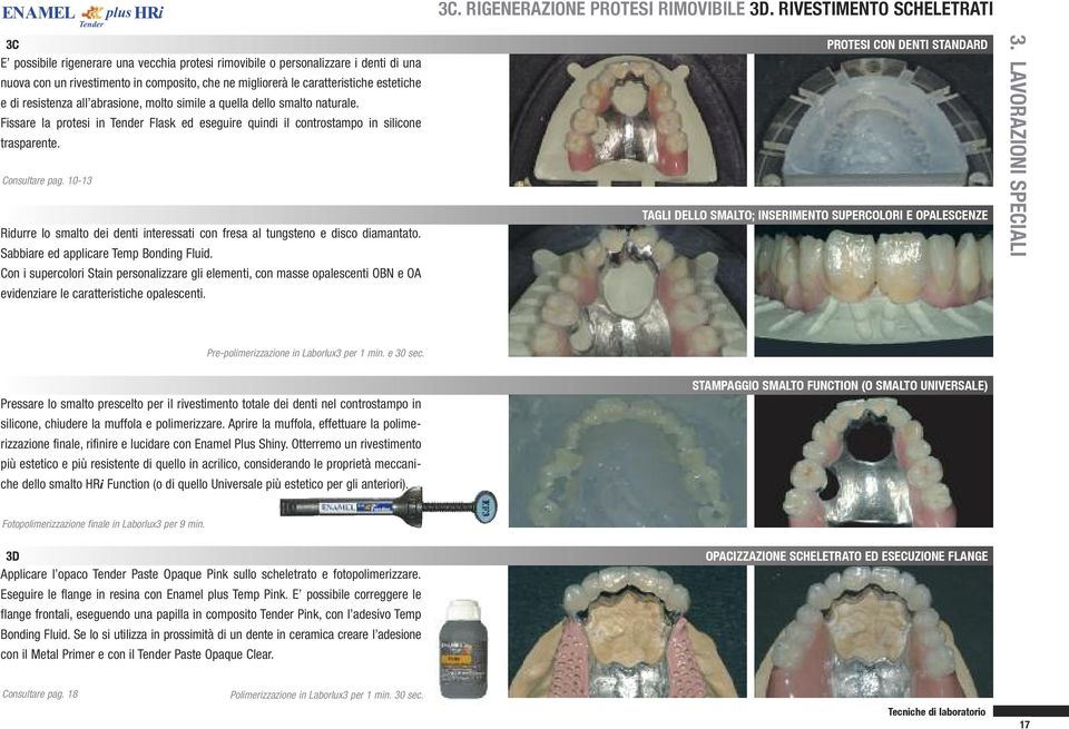 10-13 Ridurre lo smalto dei denti interessati con fresa al tungsteno e disco diamantato. Sabbiare ed applicare Temp Bonding Fluid.