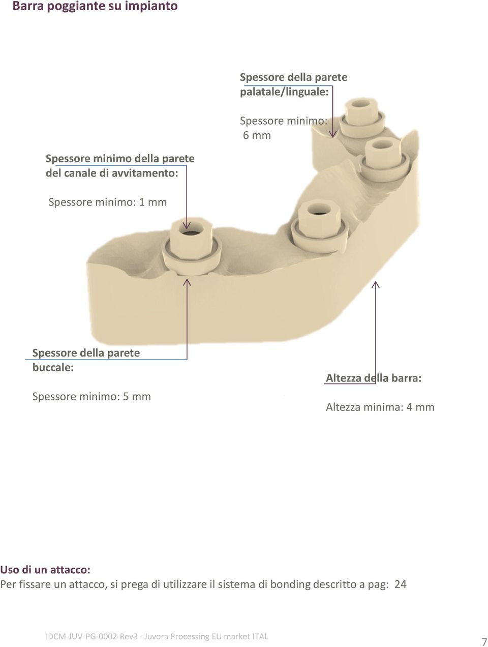 parete buccale: Spessore minimo: 5 mm Altezza della barra: Altezza minima: 4 mm Uso di un