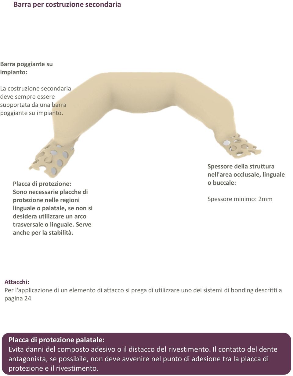 Spessore della struttura nell'area occlusale, linguale o buccale: Spessore minimo: 2mm Attacchi: Per l'applicazione di un elemento di attacco si prega di utilizzare uno dei sistemi di bonding