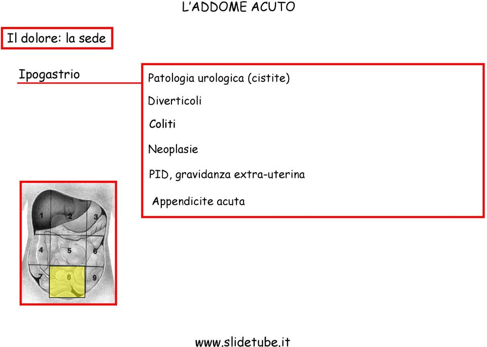 (cistite) Diverticoli Coliti