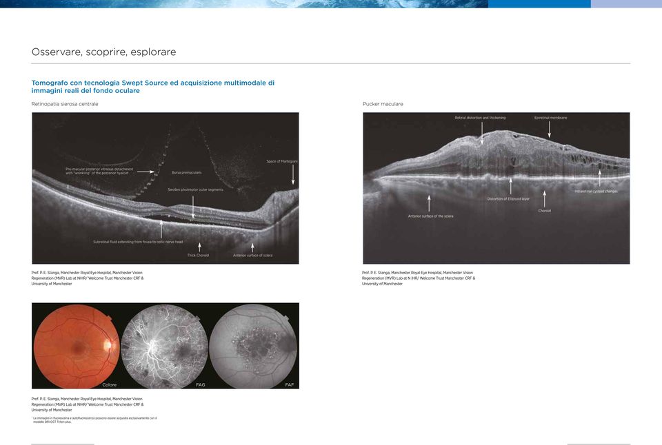 P. E. Stanga, Manchester Royal Eye Hospital, Manchester Vision Regeneration (MVR) Lab at NIHR/ Welcome Trust Manchester CRF & University of Manchester * Le immagini in fluoresceina e