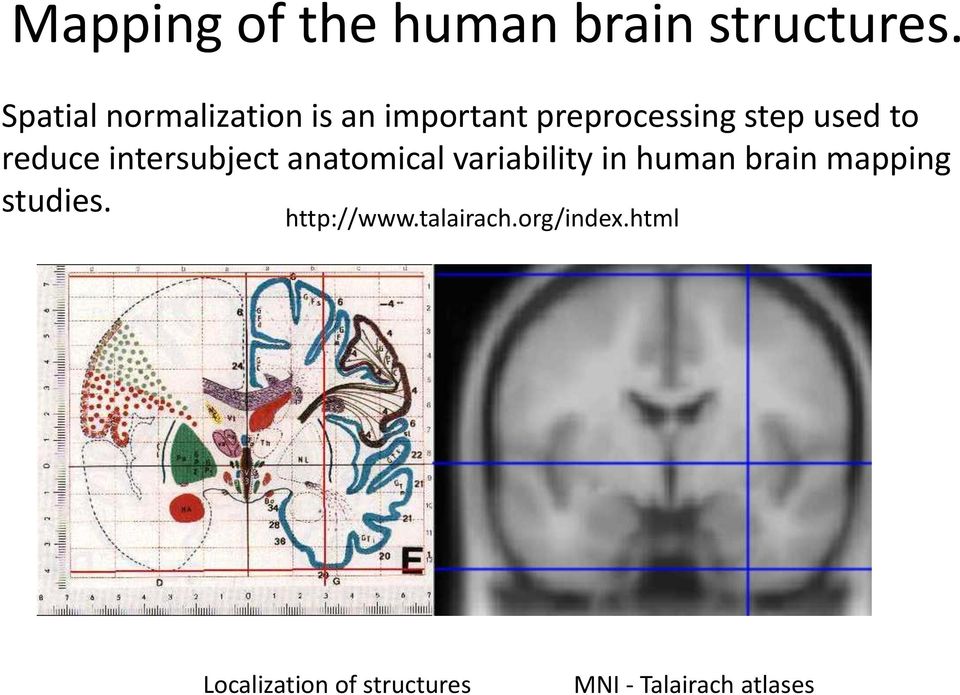 reduce intersubject anatomical variability in human brain mapping